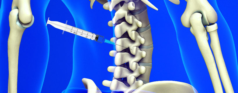 patient receiving Facet Joint Injections in Allen for auto accident injury pain relief