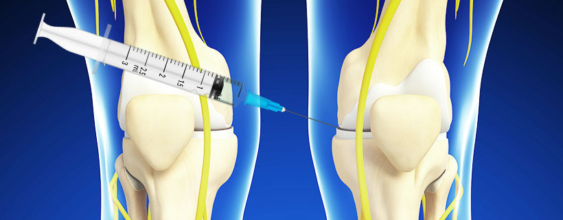 patient receiving HYALGAN Injections in Allen for auto accident injury pain relief