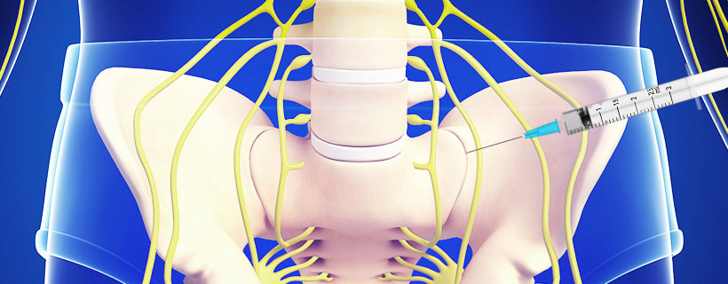 patient receiving Sacroiliac Joint Steroid Injections in Allen for auto accident injury pain relief