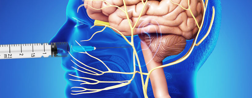 patient receiving Sphenopalatine Ganglion Block in Allen for auto accident injury pain relief