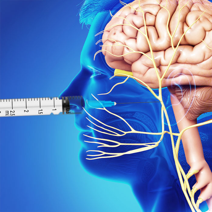 sphenopalatine ganglion block in Allen