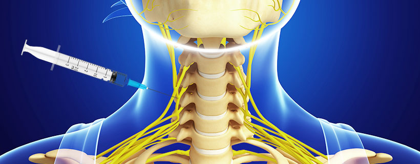 patient receiving Stellate Ganglion Block in Allen for auto accident injury pain relief